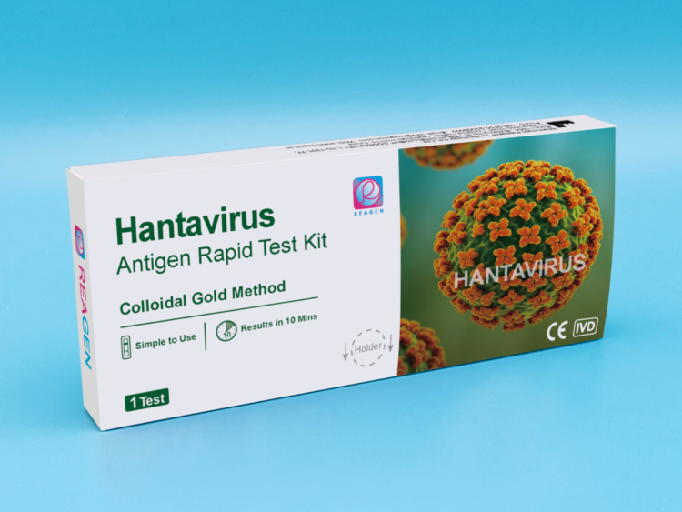 Hantavirus Antigen Rapid Test Kit