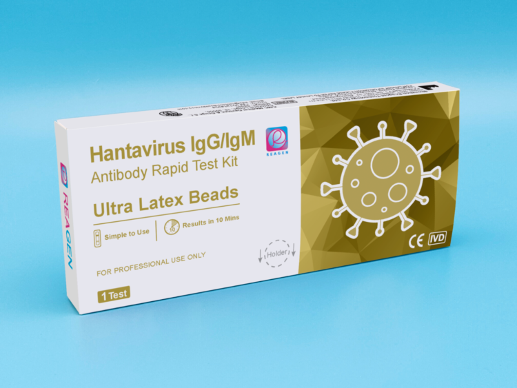 Hantavirus IgG/IgM Antibody Rapid Test Kit