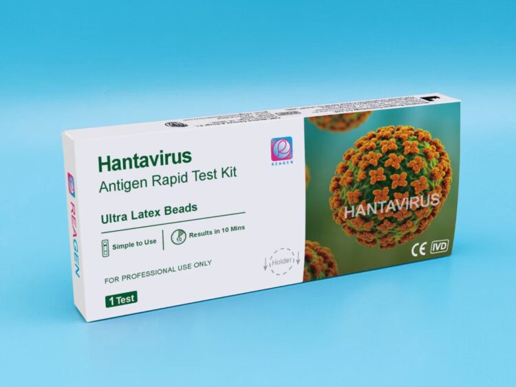 Hantavirus Antigen Rapid Test Kit