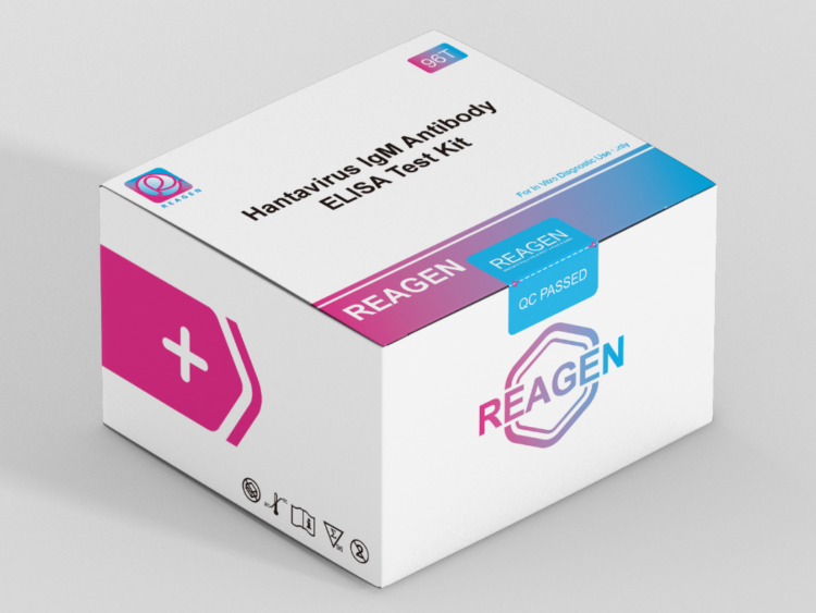 Hantavirus IgM Antibody ELISA Test Kit