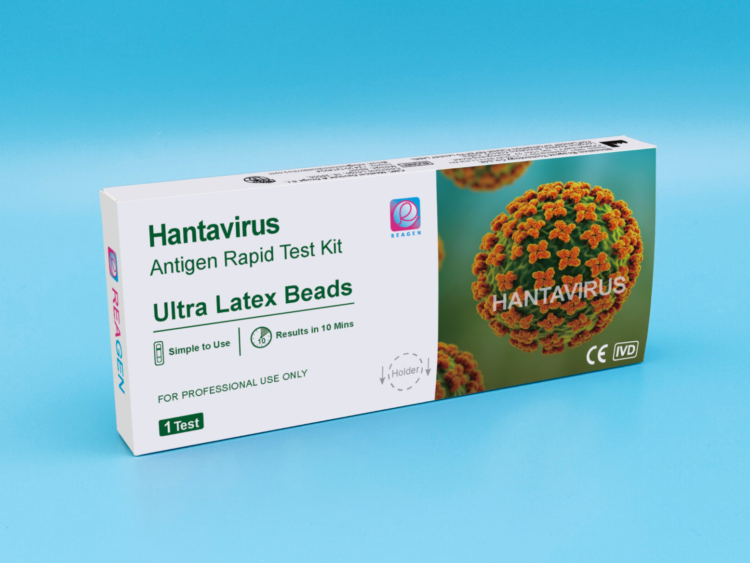 Hantavirus Antigen Rapid Test Kit