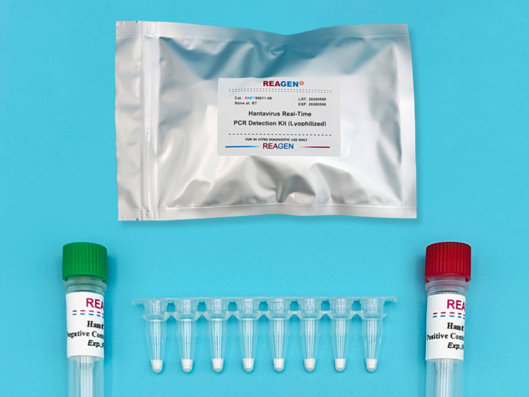 Hantavirus Real-Time PCR Detection Kit (Lyophilized)